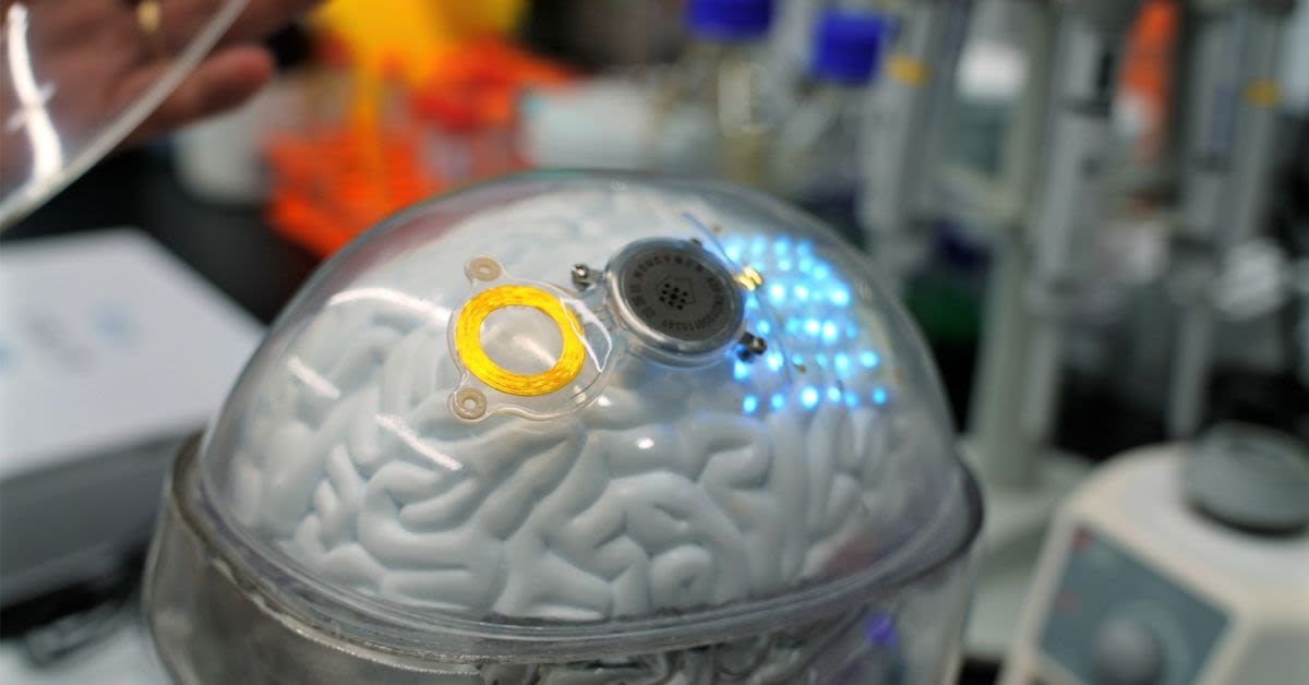 China Beats Neuralink To Market With First Commercial Brain Chip Implant