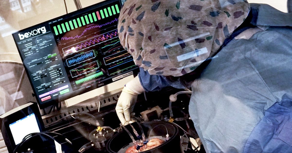 There Is A Secretive Lab Reviving Hundreds Of Dead Human BrainsCritics Warn Ethics Dont Exist Here